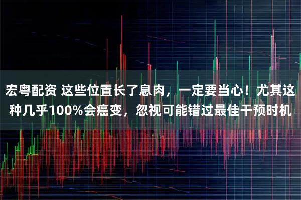 宏粤配资 这些位置长了息肉，一定要当心！尤其这种几乎100%会癌变，忽视可能错过最佳干预时机